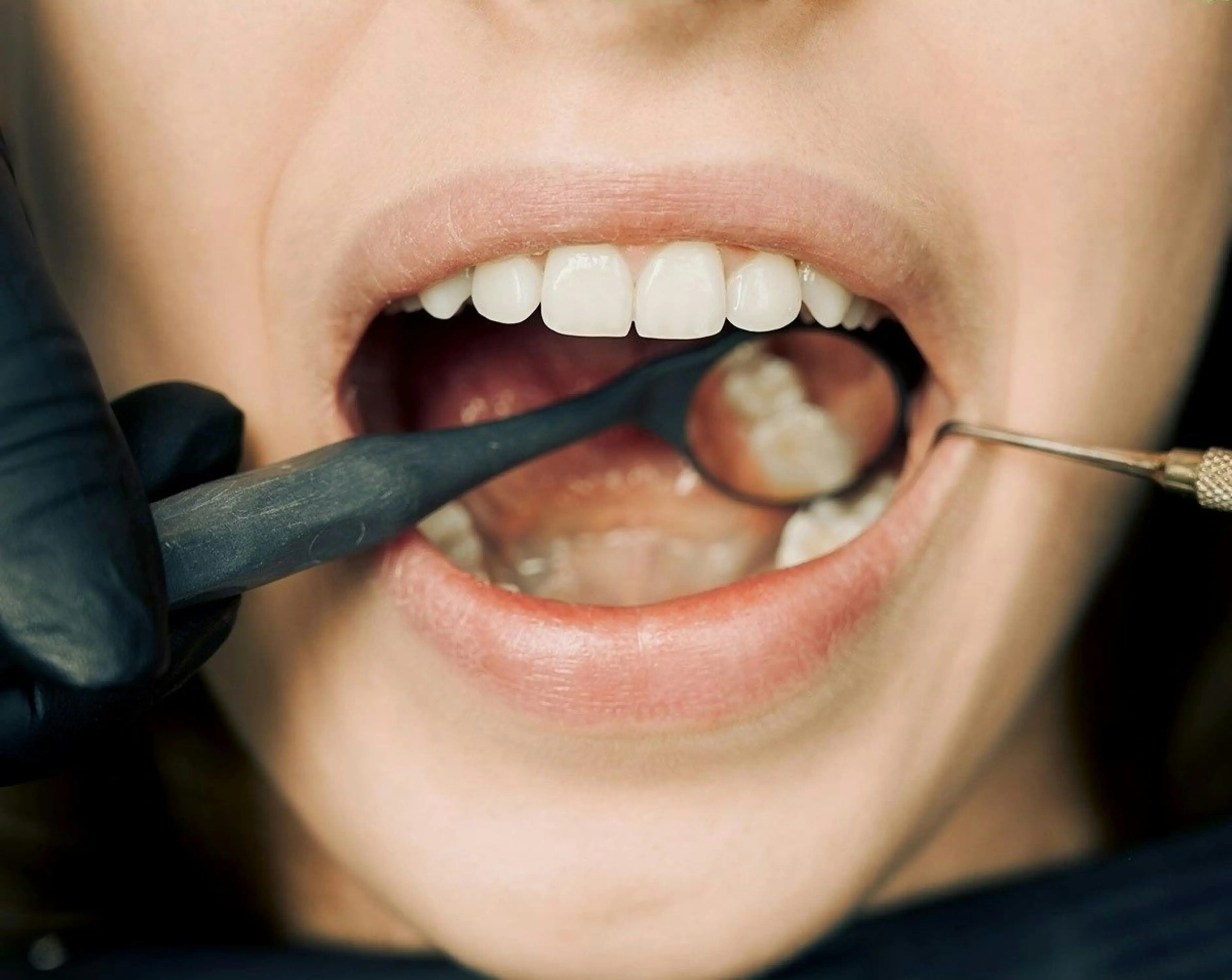 Dental Check-Up