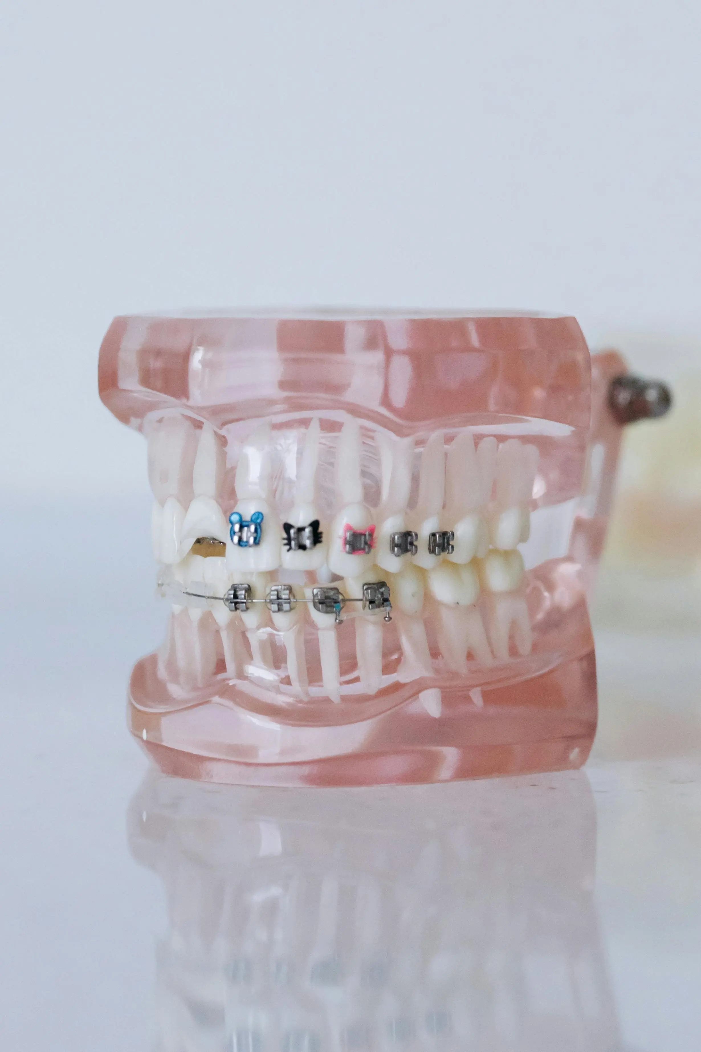 Orthodontic Treatment